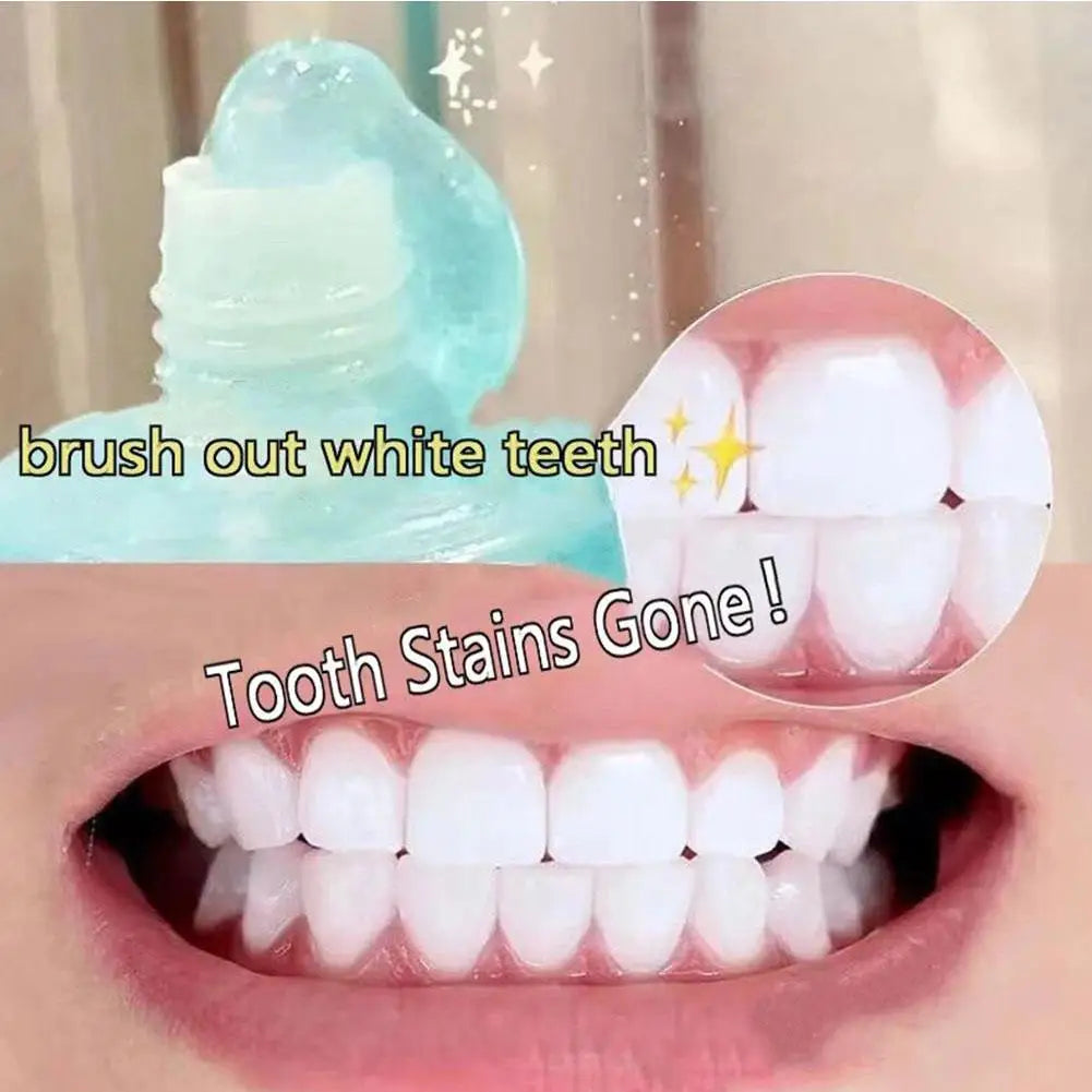Niacinamide Whitening Toothpaste Remove Plaque Stains Reduces Plaque Teeth Oral Hygiene Clean Fresh Breath Toothpaste Teeth Care