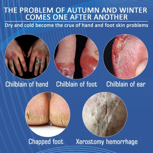 South Moon Skin Cream Foot And Heel Nourishing Care  External Application